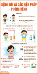 BÀI TUYÊN TRUYỀN  PHÒNG CHỐNG BỆNH SỞI